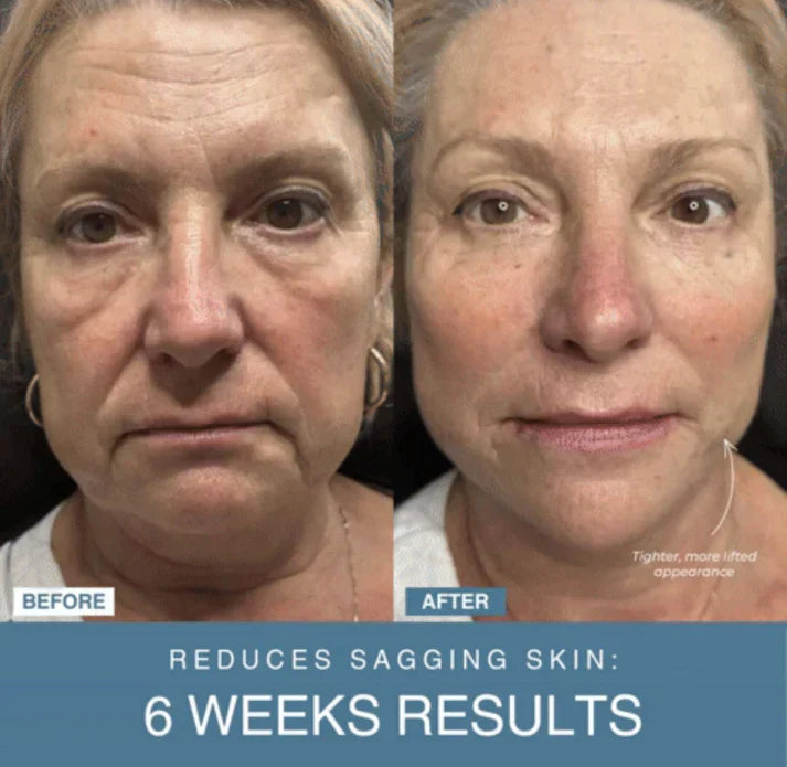 Shopia™ 7-in-1 LED Anti-Aging/Wrinkle Apparatus