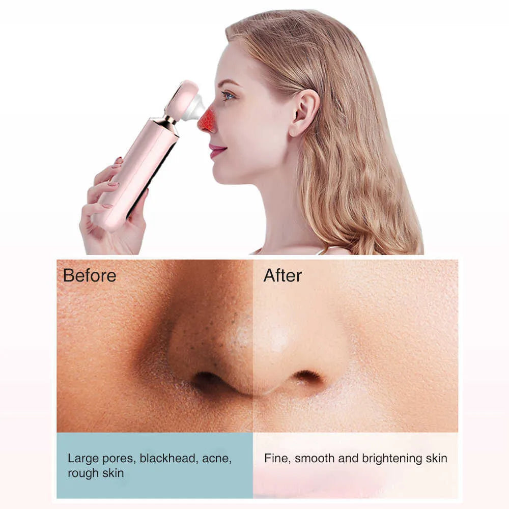 Shopia™ Blackhead Suction Machine