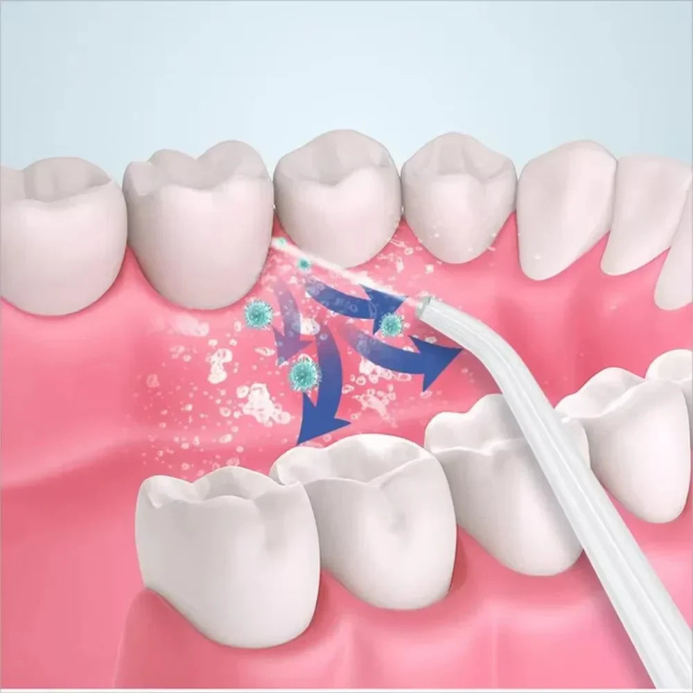 Shopia™3 In 1 Oral Irrigatorجهاز ري الفم 3 في 1