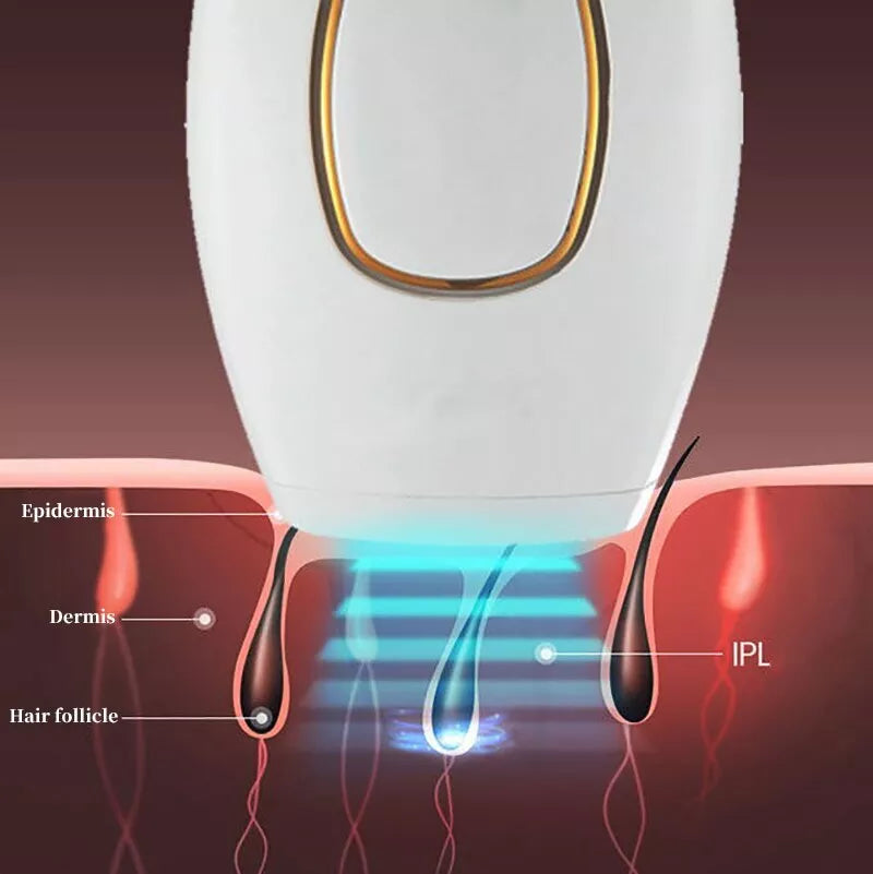 Shopia™ IPL Laser Hair Removal – جهاز إزالة الشعر بالليزر IPL